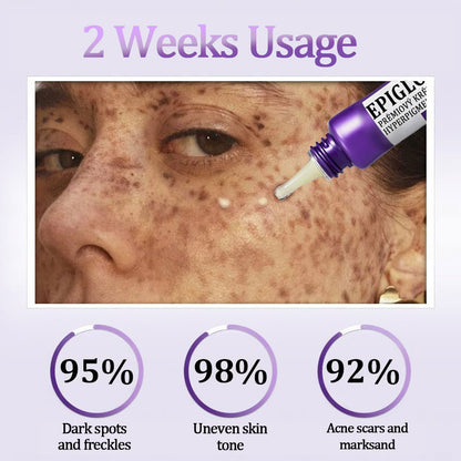 💜©︎[Official Store] Fubsta® EPIGLOW MelanEX premium cream against hyperpigmentation | ✅Complies with US high standard cosmetic regulations