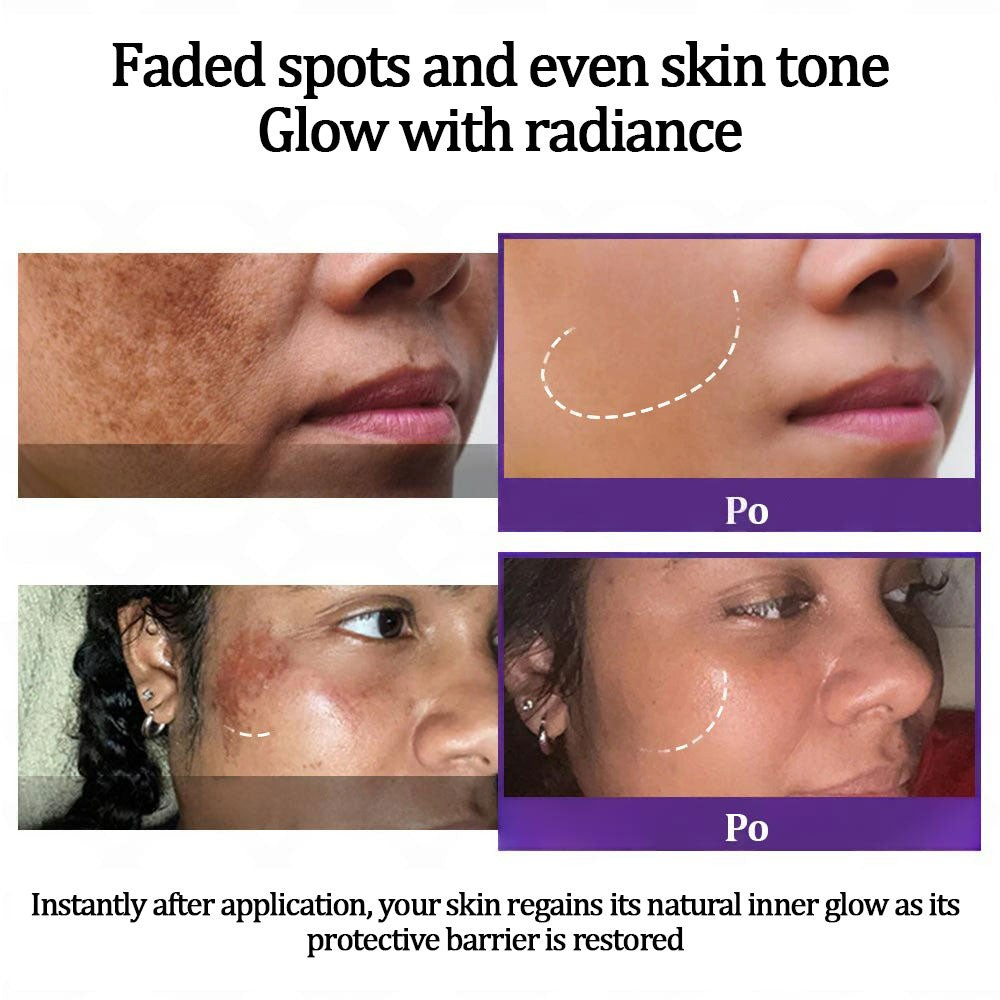 💜©︎[Official Store] Fubsta® EPIGLOW MelanEX premium cream against hyperpigmentation | ✅Complies with US high standard cosmetic regulations